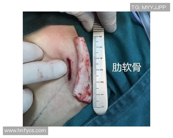 篮球明星为何没有鼻子与肋骨的神秘传说与背后故事解析 篮球明星为何没有鼻子与肋骨的神秘传说与背后故事解析